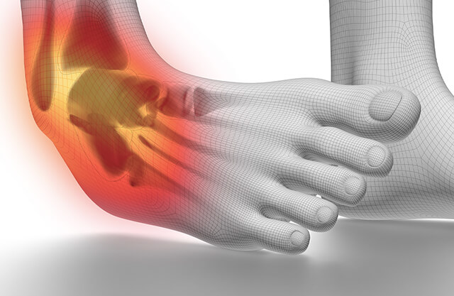 Ankle Cartilage Injuries