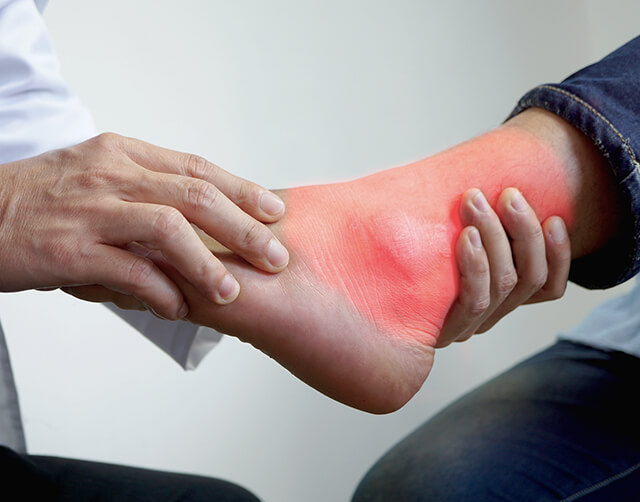 Ankle Injury